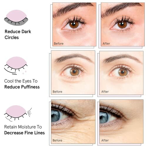 Comparison of eyes showing effects of reducing dark circles, puffiness, and fine lines.