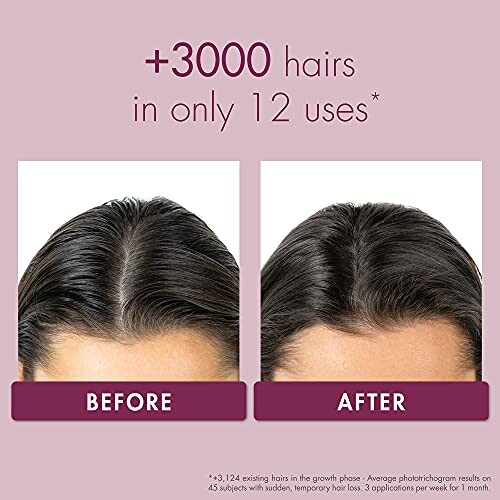 Comparison of hair growth before and after using Klorane serum, showing increased hair density.