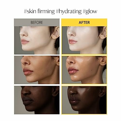 Before and after skin care comparison showing firming and hydrating effects.