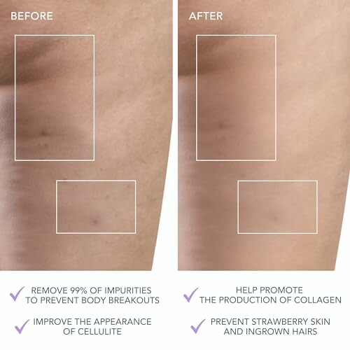 Comparison of skin before and after treatment showing reduced blemishes and smoother texture.