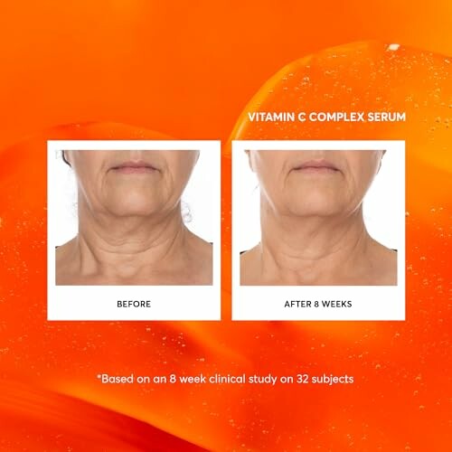 Comparison of neck area before and after 8 weeks using Vitamin C Complex Serum.