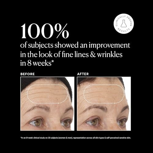 Before and after images showing wrinkle reduction on forehead with text stating 100% improvement in 8 weeks.